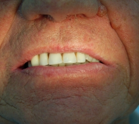 dental solution deployed