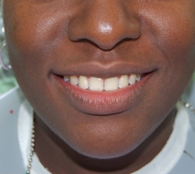 Balanced beautiful smile