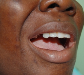 initial patient image
