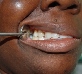 healing of process of patient